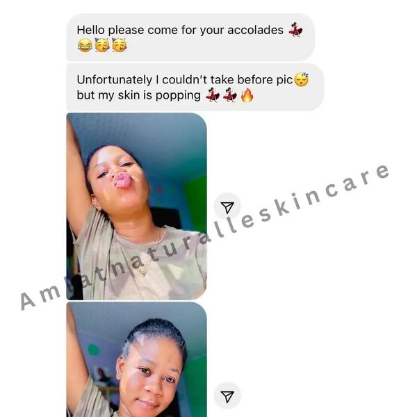 Zainab K. Amlat Ultra Glow Kit result