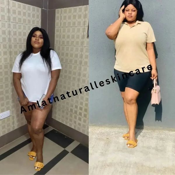 Precious E. Amlat Ultra Glow Kit result
