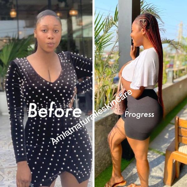 Adaeze O. Amlat Ultra Glow Kit result
