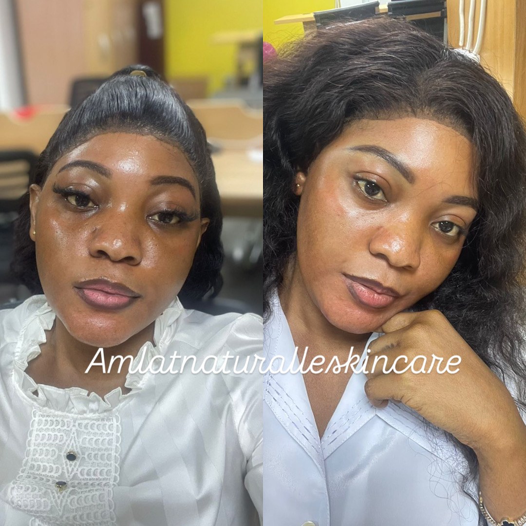Funmilayo A. Amlat Ultra Glow Kit result